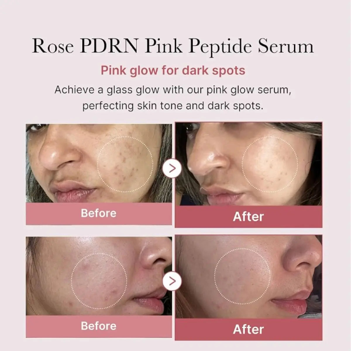 Medicube PDRN Pink Peptide Serum 30ml