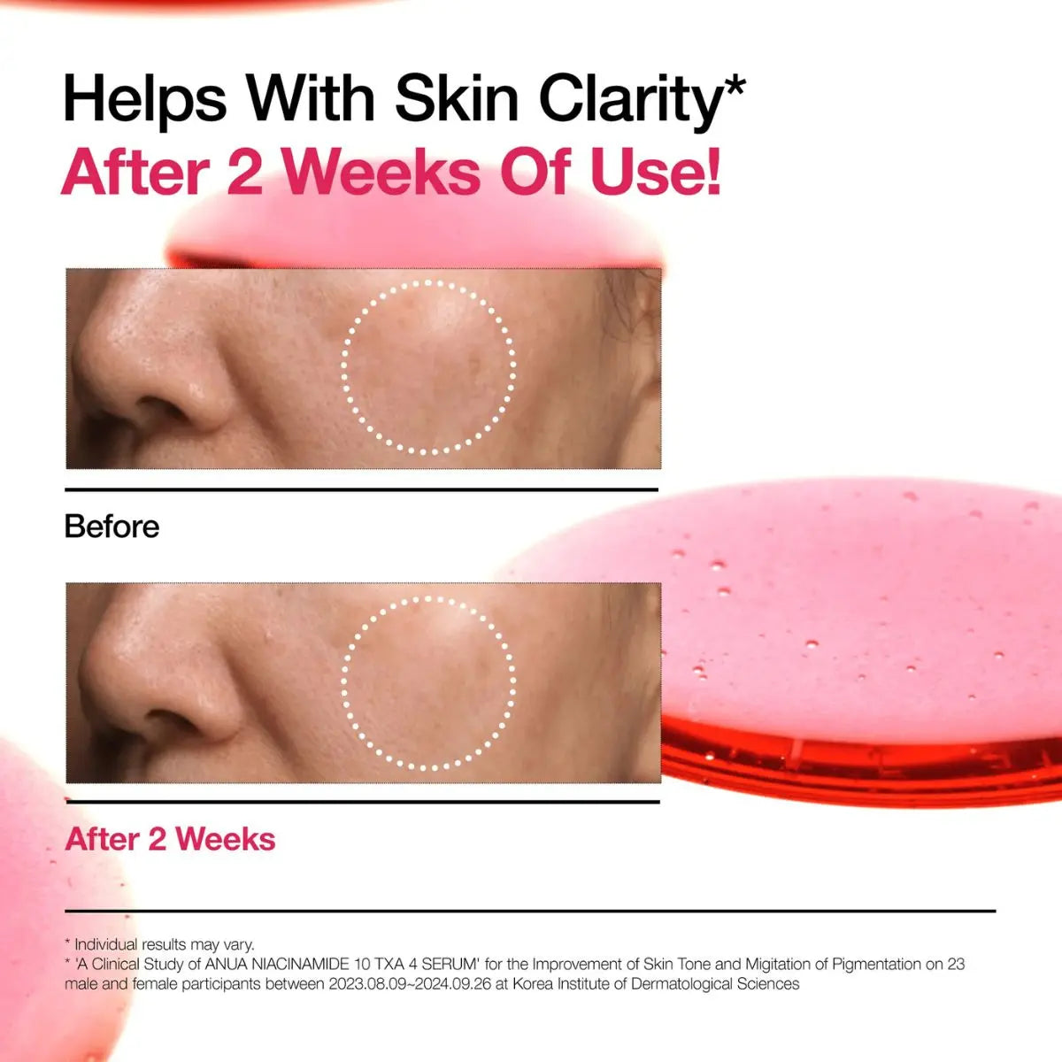 ANUA Niacinamide 10 % + TXA 3% Serum 30ml